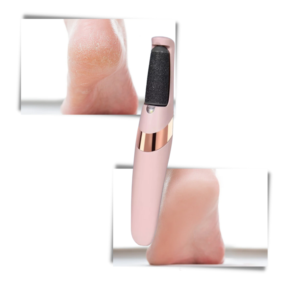 Râpe électrique pour les pieds rechargeable, deux vitesses
