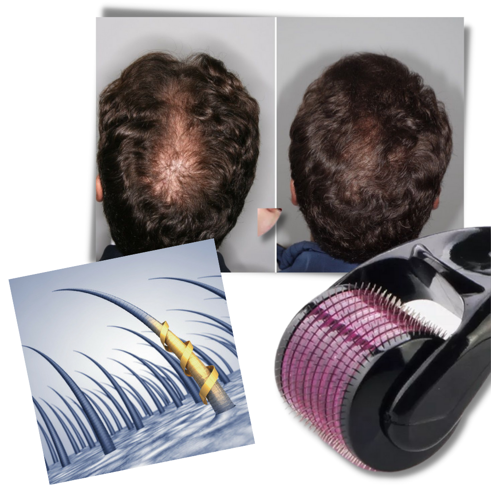 Rouleau à 540 micro-aiguilles pour crâne et barbe