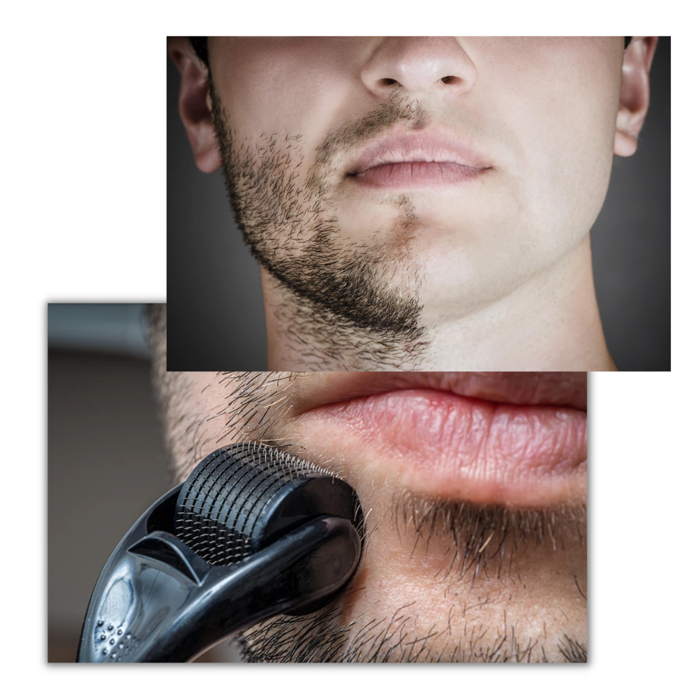 Rouleau à 540 micro-aiguilles pour crâne et barbe