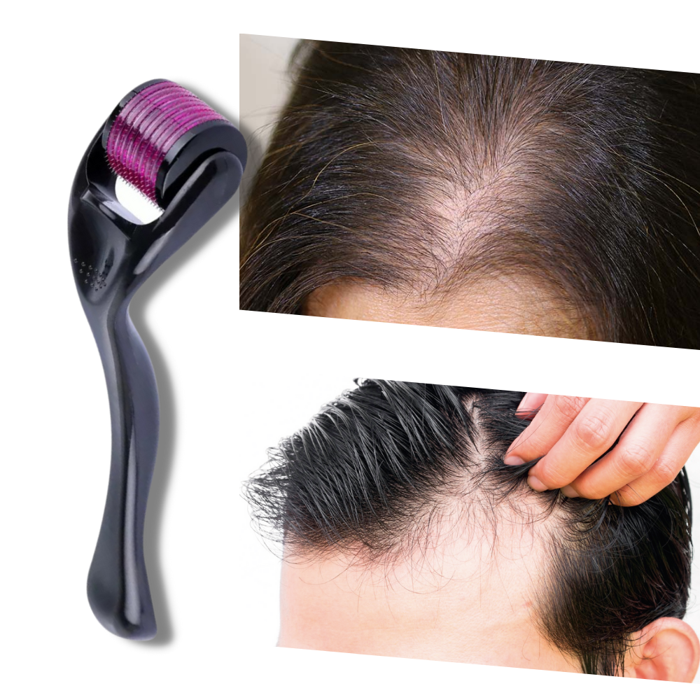 Rouleau à 540 micro-aiguilles pour crâne et barbe