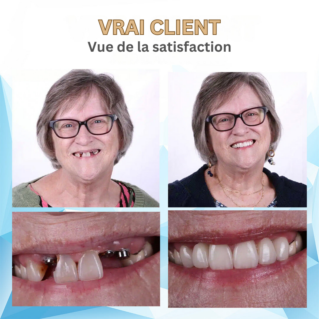 Kit de prothèses dentaires amovibles en silicone, haut et bas