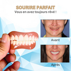 Kit de prothèses dentaires amovibles en silicone, haut et bas