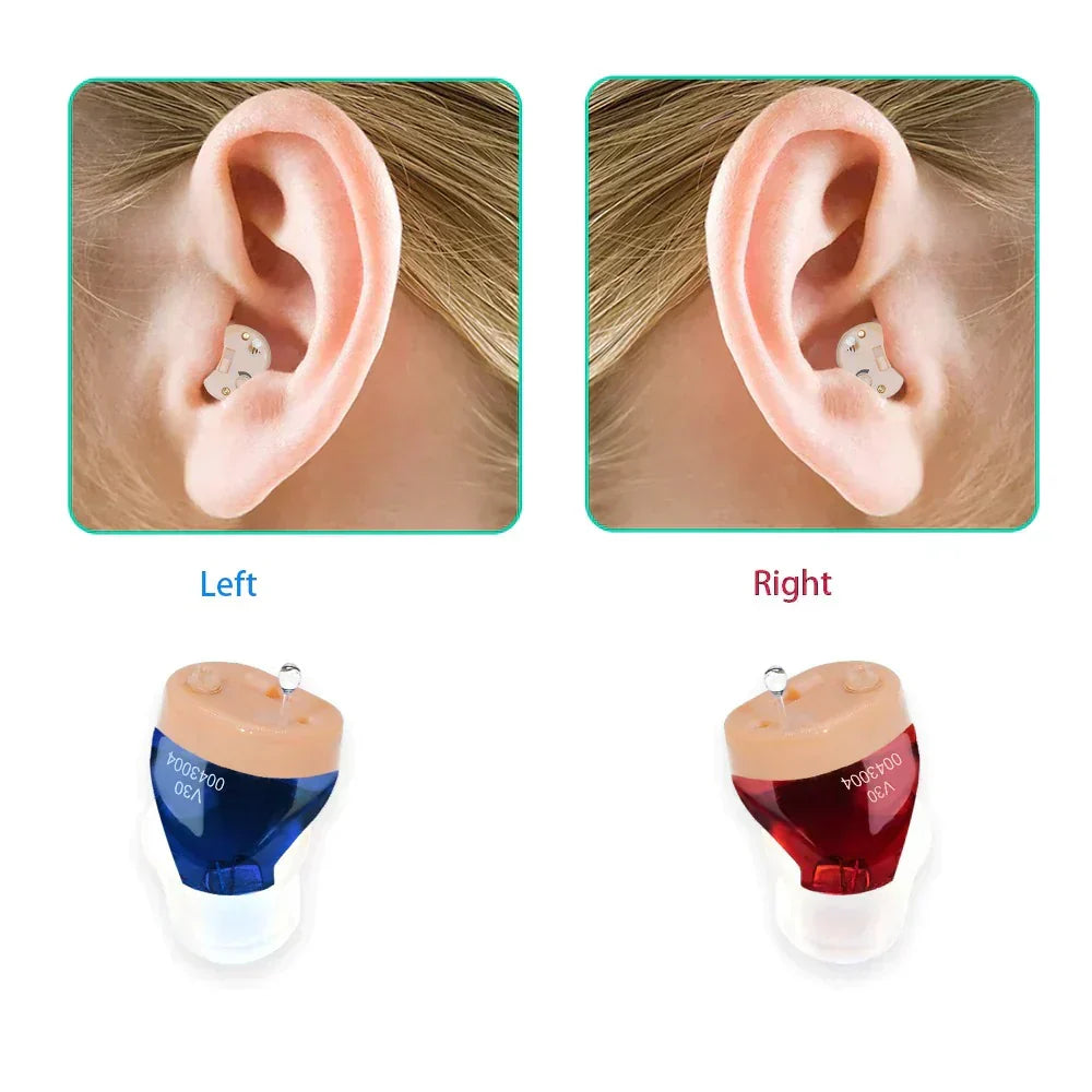 Amplificateur auditif intra-auriculaire rechargeable, étui de charge
