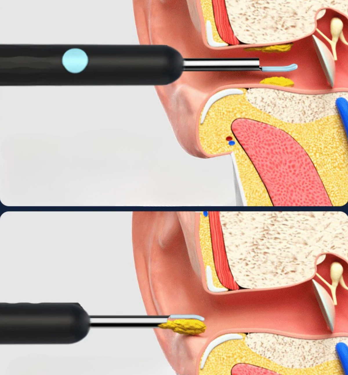 Caméra pour oreilles HD avec 6 LED, application Wi-Fi, étanche IP67