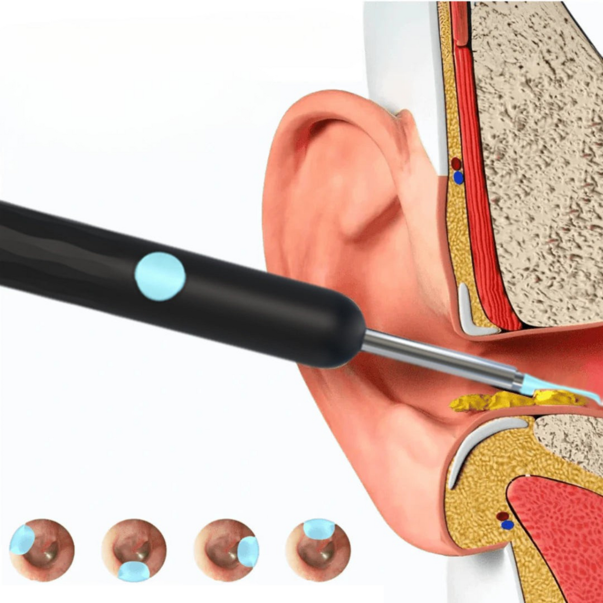 Caméra pour oreilles HD avec 6 LED, application Wi-Fi, étanche IP67