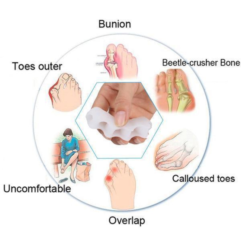 Séparateur d'orteils orthopédique en gel de silicone souple