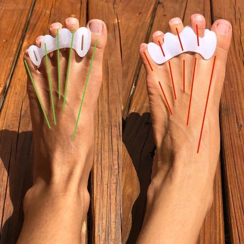Écarteurs d'orteils en silicone souple, lot de deux, S, M ou L