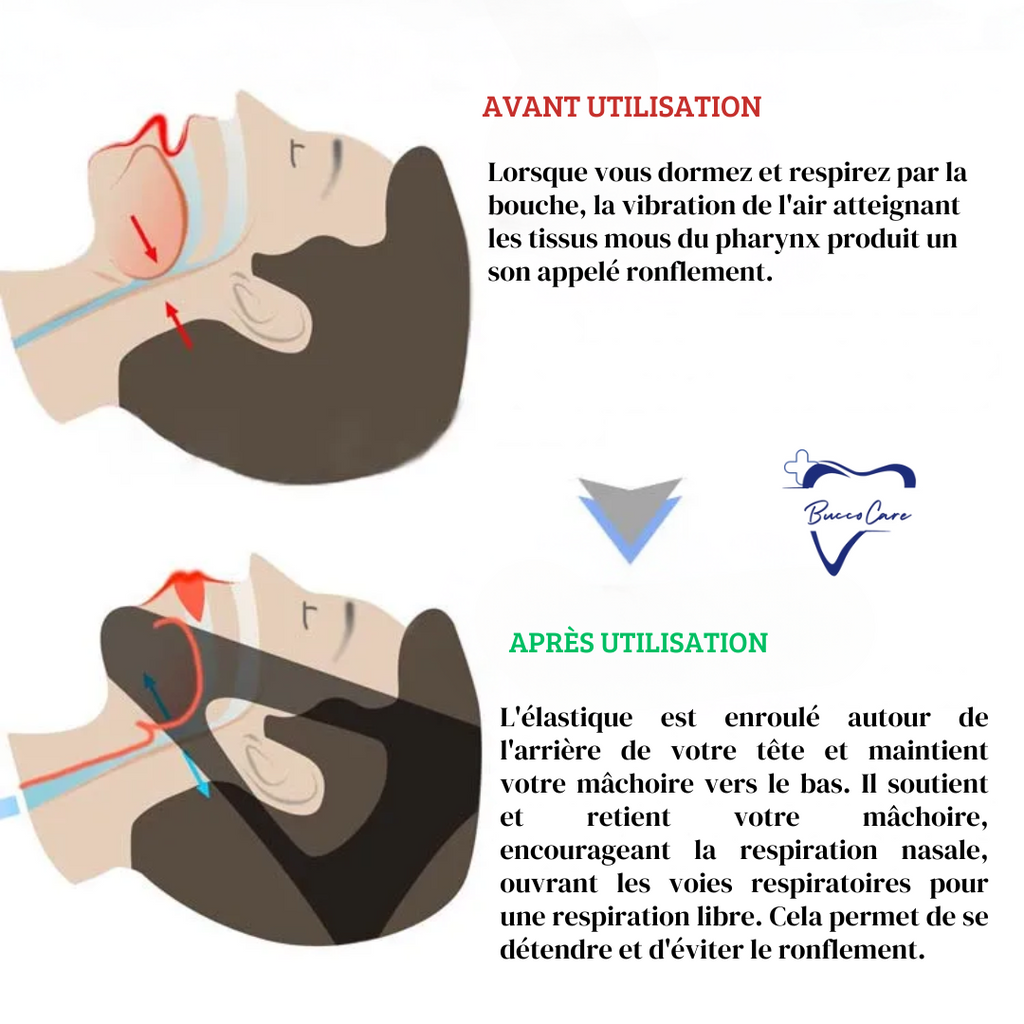 Orthèse de nuit ergonomique, noire ou bleue